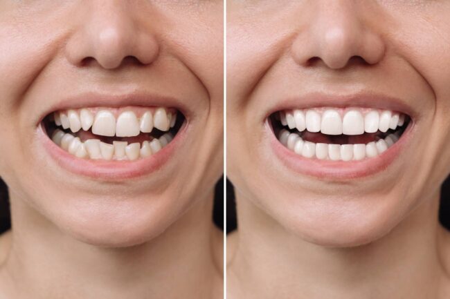 Chicago Cosmetic Dentist